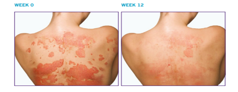 تاثیر استلارا